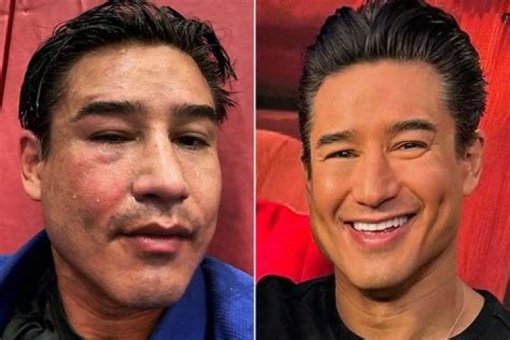 Why is mario lopez famous